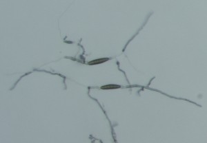 Bipolaris sorokiniana conidia germinating from the poles. Photo: Sabrina Tirpak, Rutgers PDL